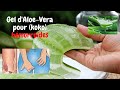 Aloe Vera Pour Koko Hémorroïdes Aloe Vera Gel