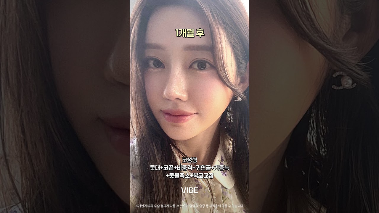 코성형(콧대+코끝), 비중격, 귀연골, 기증늑, 콧볼축소, 복코교정