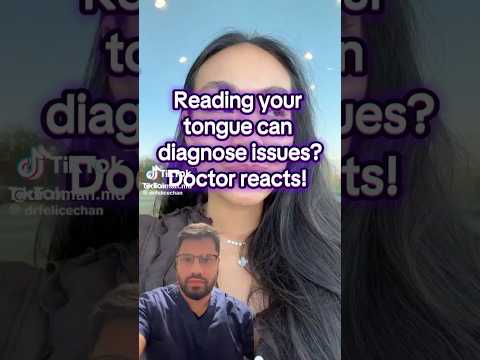 Can You Read Health From the Tongue? Debunked 👅