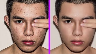Fastest way to clean your face in photoshop | Remove pimples, blemishes, acne easily