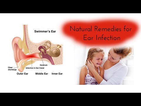 Best Natural Remedies for Ear Infection fast