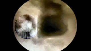 SUN SPECIAL • NEVER SEEN BEFORE • There is Life on the SUN!! Watch my Video No. 41