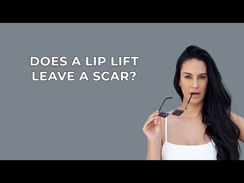 Does an Upper Lip Lift Leave Scars? With Dr. Nazarian in Beverly Hills | Nazarian Plastic Surgery