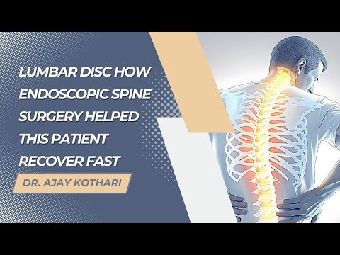 L5-S1 Lumbar disc How Endoscopic Spine Surgery Helped This Patient Recover Fast | Dr. Ajay Kothari