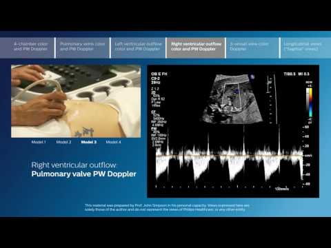 Part 4 - Right ventricular outflow color and PW Doppler