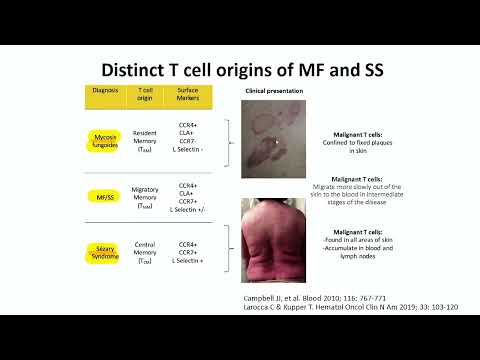 Unravelling the Role of CCR4 as a therapeutic target in CTCL –Dr. John Apostolidis(Sep 15-16, 2023)