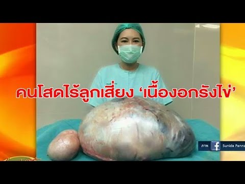 ชอบความแรง uvilichit เป็นผลิตภัณฑ์สำหรับแรง