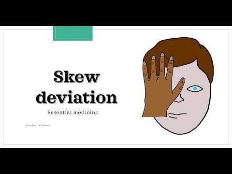 Skew deviation test / Test of Skew [Essential medicine]
