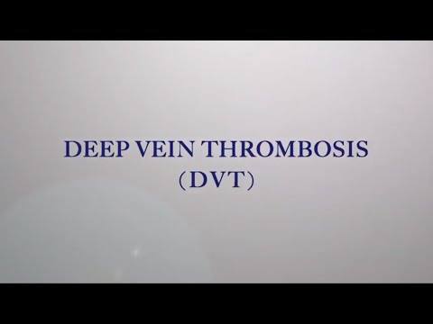Acute Deep Vein Thrombosis (DVT)