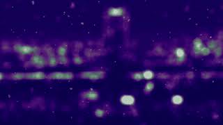 lil durk “skrubs” •slowed~reverb•