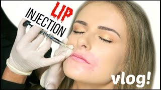 GETTING LIP INJECTIONS // VLOG + Q&A!