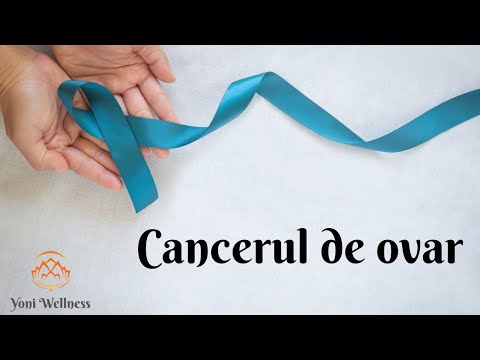 S2.Ep 64 - Cancerul de ovar | Neoplasmul ovarian | Cel mai periculos cancer feminin | Nu dă simptome