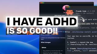 I-HAVE-ADHD Skill +  Claude,Codex,Deepseek: YOU'RE MISSING OUT without THIS SKILL!