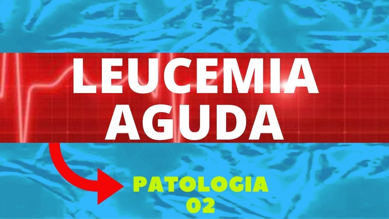 LEUCEMIA AGUDA - PATOLOGIA 2