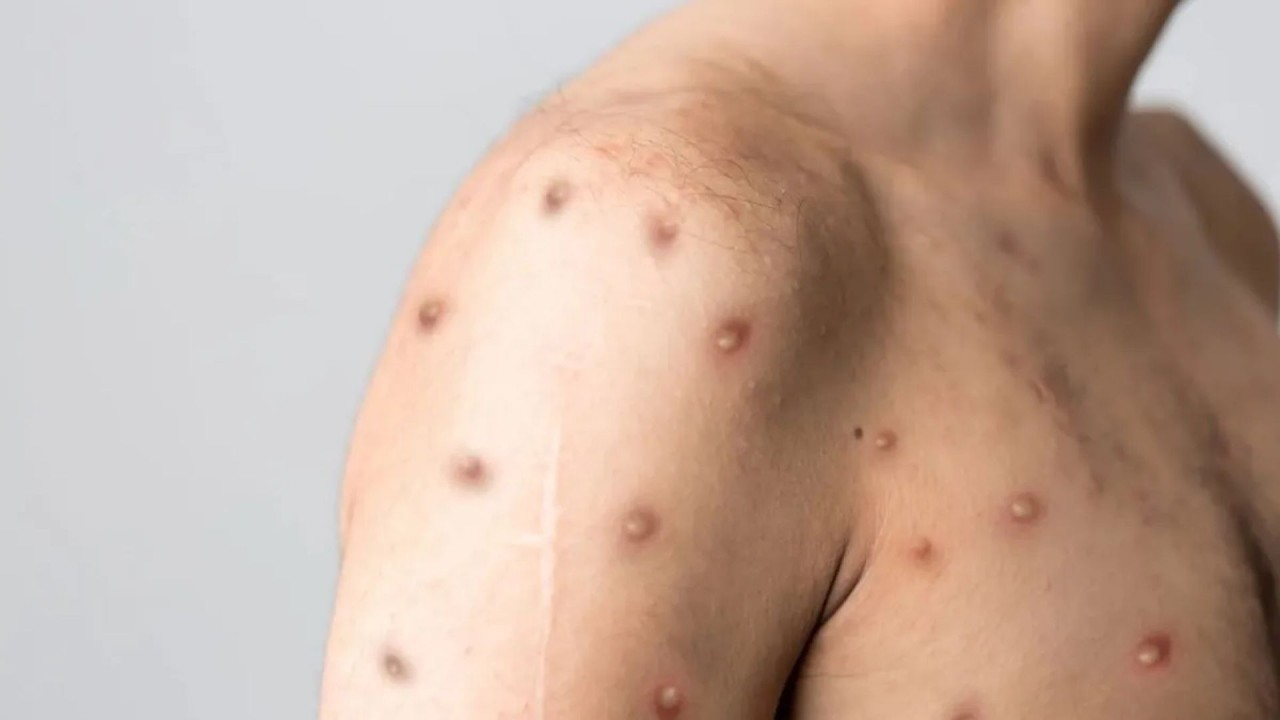 Cicero Augusto Zolli-2