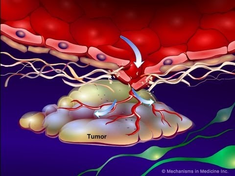 Introduction to Cancer Biology (Part 4): Angiogenesis