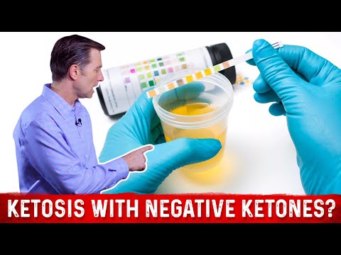 What is a Ketone Explained By Dr Berg