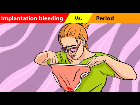 Implantation Bleeding Vs. Period (Menstrual Bleeding)