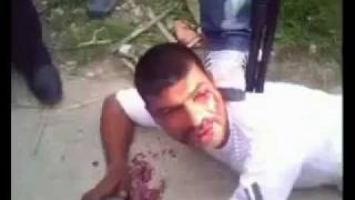preview picture of video 'Siria, Baniyas, Al Bayida, HOMBRE TORTURADO por MILICIAS CRIMINALES del Regimen, 04/2011'