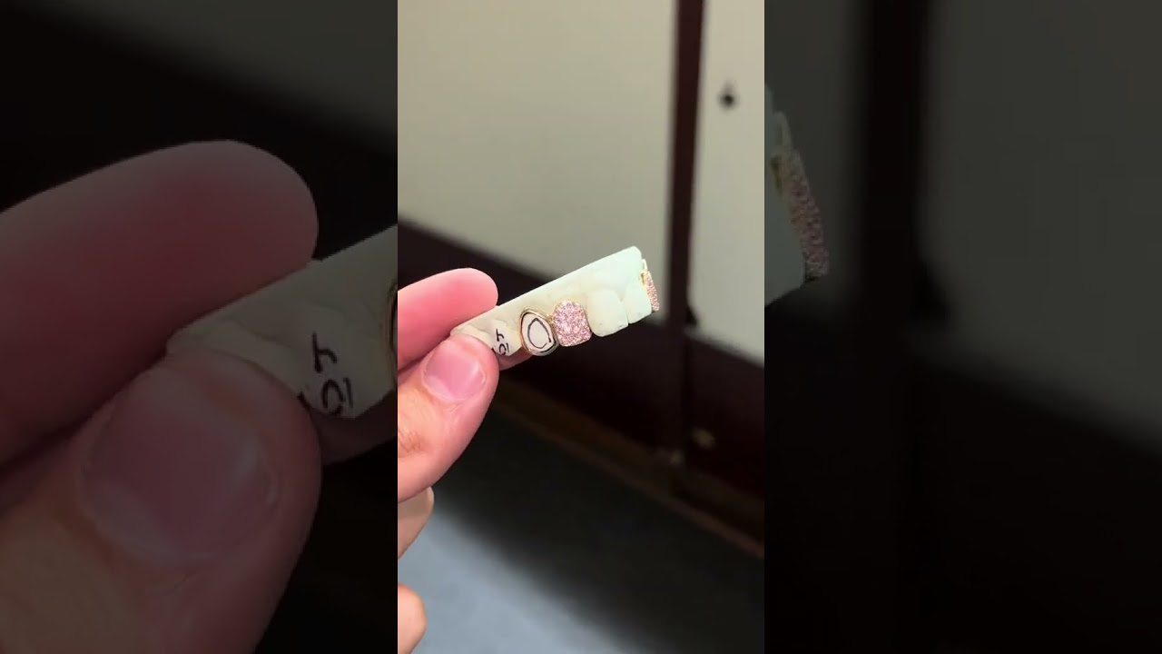 Ladies Real Gold & Natural Pink Birthstone Grillz #grillz #fashion #finejewelrycollection2022