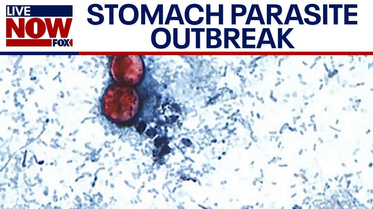 Cyclosporiasis outbreak: What we know about the stomach parasite