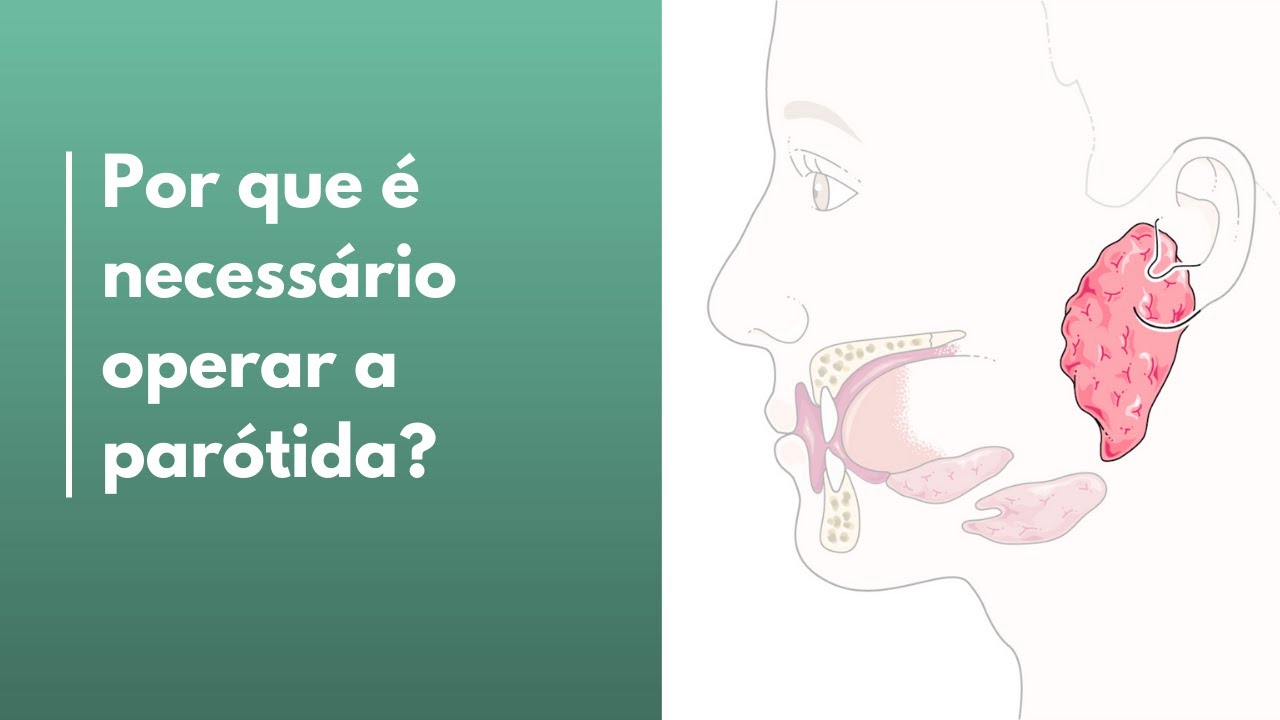 Curiosidades sobre a parótida!