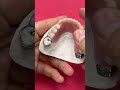 Titanium Partial that clasps to a Single Tooth