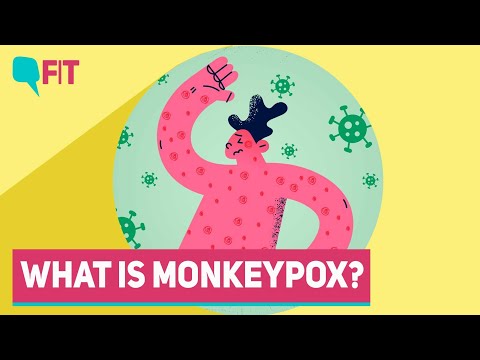 Monkeypox Cases Detected in More Countries: What Is It? How Does It Spread?