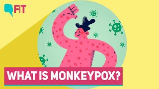 Monkeypox Cases Detected in More Countries: What Is It? How Does It Spread? | The Quint