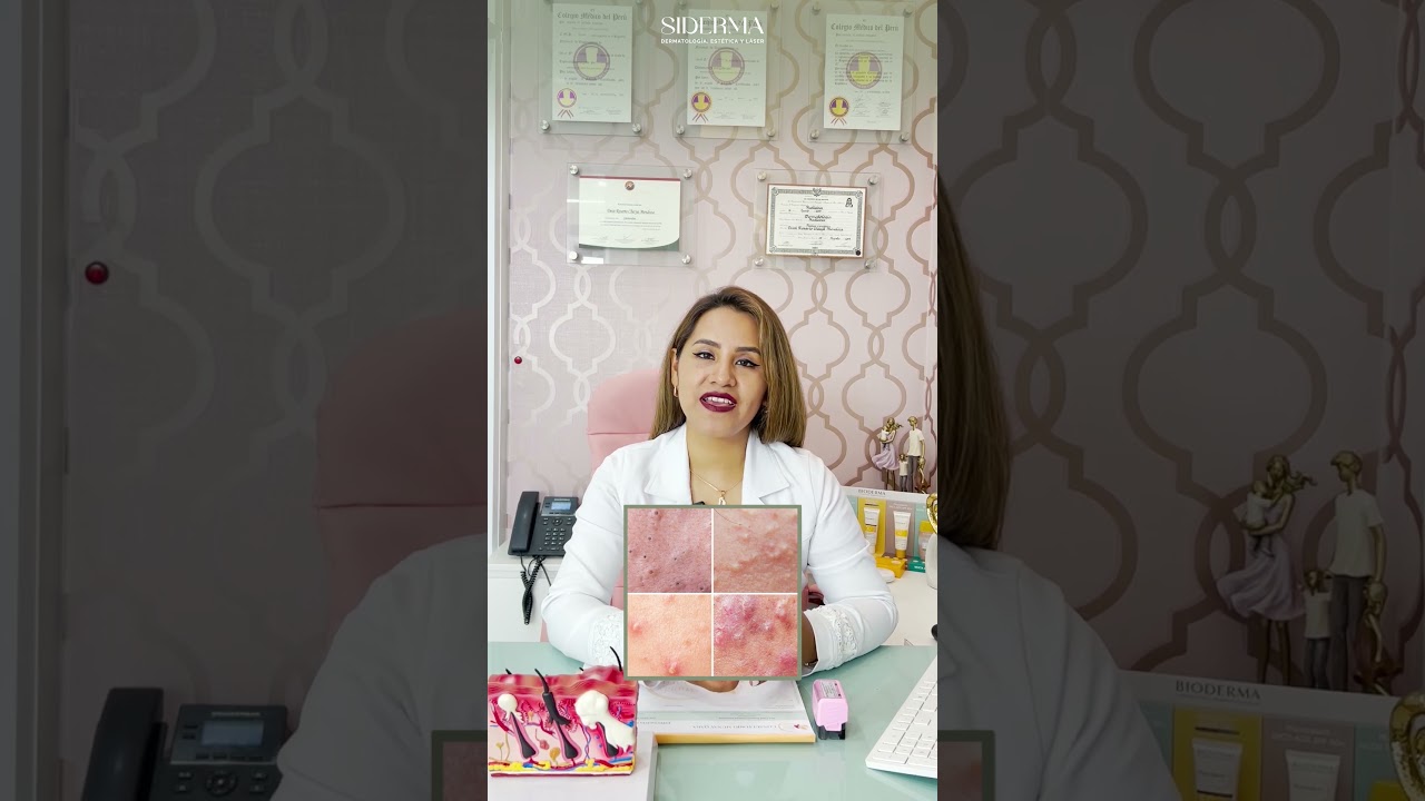 Deisi Rosario Checya Mendoza-4