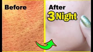 Apply it 3 Night SKIN Repair Overnight How to get rid of Large OPEN PORES permanently NATURALLY