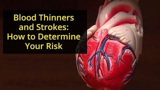 Blood Thinners and Strokes: How to Determine Your Risks