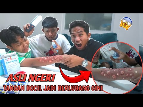 OH MY GOD, DID THE KEN4 KAC4R WATER END THIS WAY TO HIS HANDS? 😱PURI PANIC! | Mikael TubeHD