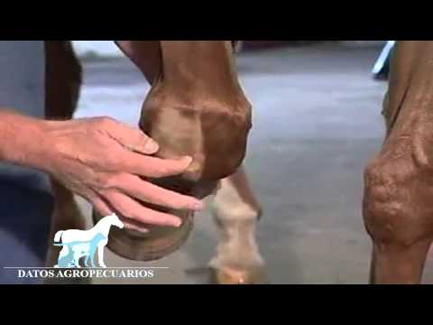 Fractura del cóndilo interno de la articulación del codo Cinturón para la articulación de la rodilla