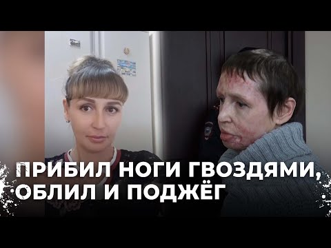 She was burned alive and endured torture. Exclusive interview with Shchegolikhin's victim