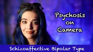 I'm in Psychosis. | Psychotic Episode Caught on Camera
