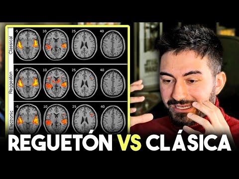 Qué sucede con el cerebro si escucha reguetón vs si escucha música clásica - Científico lo cuenta