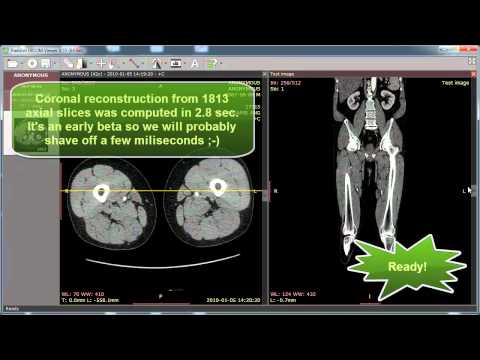 Phần mềm phân tích ảnh y khoa DICOM