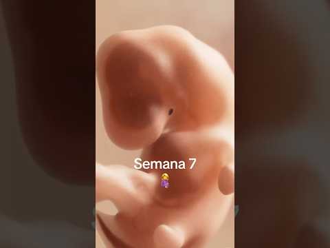 Week 7 of pregnancy. We see brain 🧠 and heart 🩷 #ultrasound #pregnancy