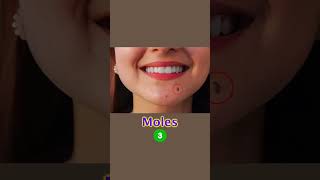 Download lagu How to manage moles & open pore: Skin Care Tips | Dr. Sarin | mp3 Download lagu How to manage moles & open pore: Skin Care Tips | Dr. Sarin | mp3