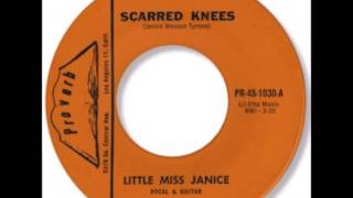 Little Miss Janice - Scarred Knees 1967