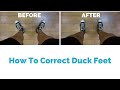 How To Correct Duck Feet Feet Turn Out Step By Step Program