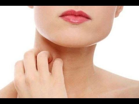 Che curare leczema sulle dita di unguento di mani Eczema di farmaco di camomilla