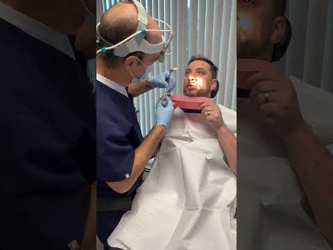 ￼ nasal splint removal six days after septoplasty endoscopic sinus surgery