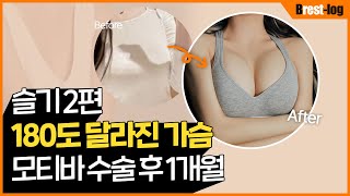 [슬기] 가슴성형 브이로그 2탄 | 당일부터 한달차 후기 | 사후관리