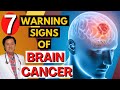 7 Warning Signs of Brain Can-cer- By Doc Willie Ong (Internist and Cardiologist)#1401