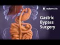Gastric Bypass Surgery Duke Health