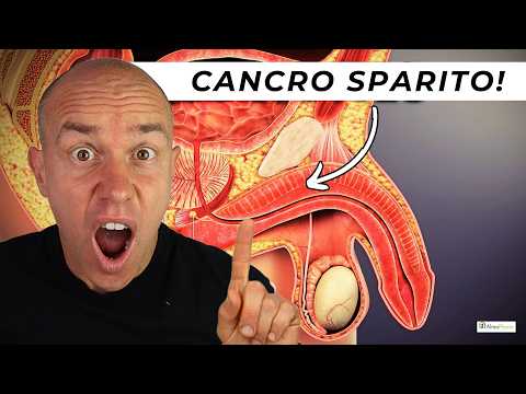 FERMARE il CANCRO ALLA PROSTATA in modo NATURALE