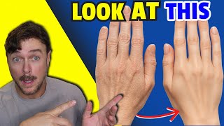 Skin Miracle Makes Your Hands Look Younger Fast