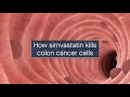 Simvastatin induces colon cancer cell death via the ROS/caspase-1/GSDMD pathway